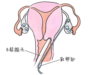 幼儿学画画，哈尔滨捐卵宝宝学画画，学画画的好处，如何学画画